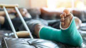Deep Vein Thrombosis