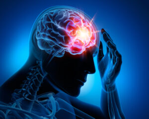 How Elrod Pope Accident & Injury Attorneys Can Help After a Brain Injury In Fort Mill, SC